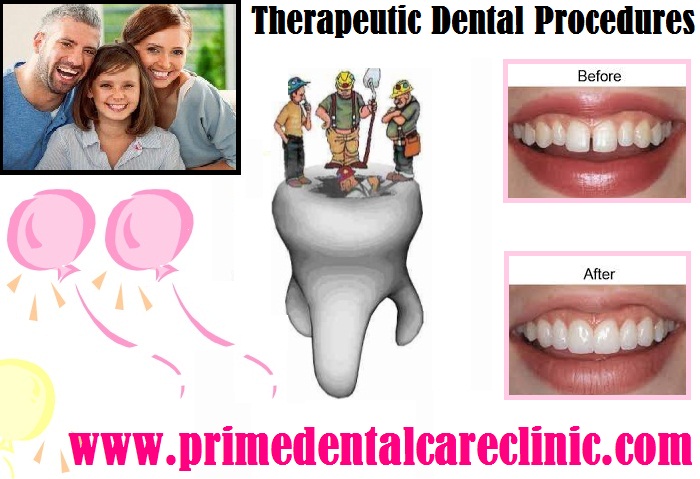 therapeutic dental procedures 
